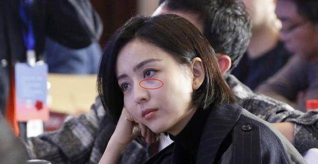 戚薇36岁佟丽娅老成这样?黑眼袋严重吓坏众人,粉丝:丫丫擦下眼霜吧