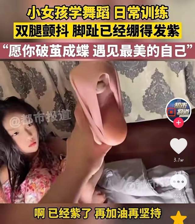 小女孩舞蹈训练脚绷到发紫网友是正常训练还是裹小脚