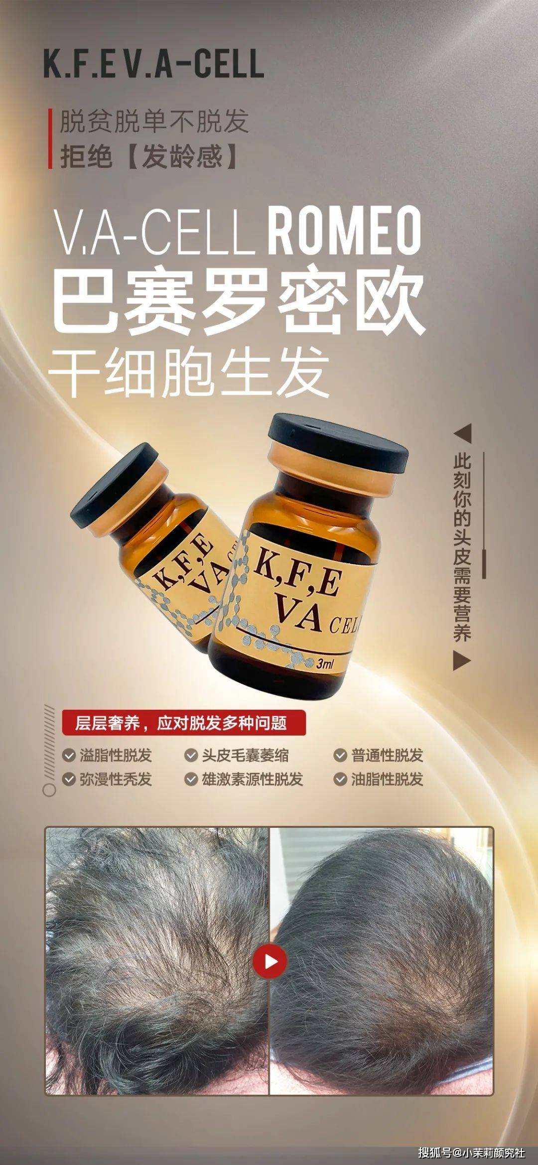 指南脱发人的自救指南！！由内而外焕回秀发之美！