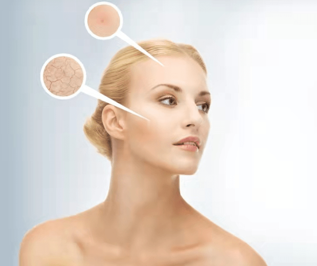 严重真相:7d聚拉提会加速衰老吗、7d聚拉提一次效果维持多久?