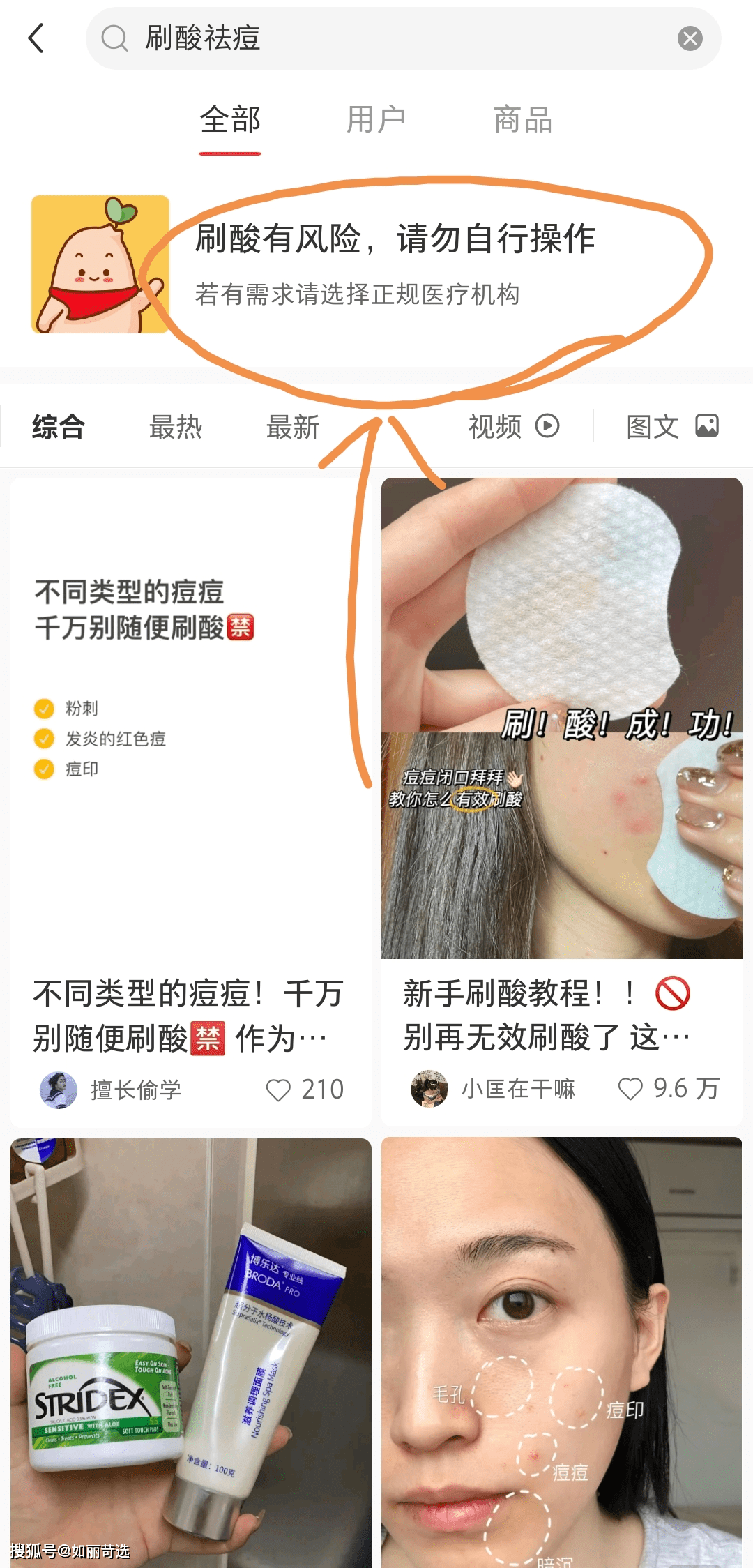 治疗痘痘只能靠医美手段改善吗？