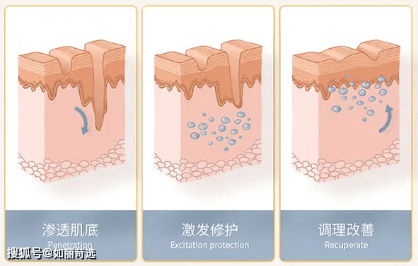 治疗痘痘只能靠医美手段改善吗？