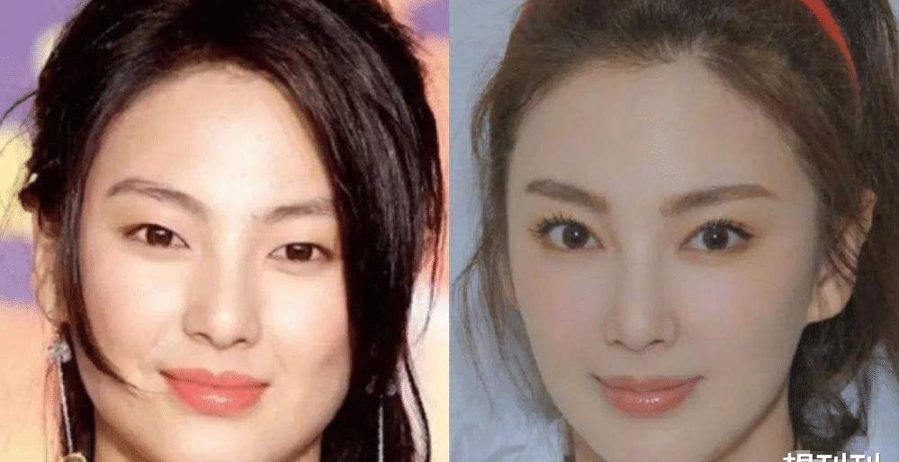 单眼皮内娱最假双眼皮PK，就差割到脑门了，生怕别人看不出是割的？