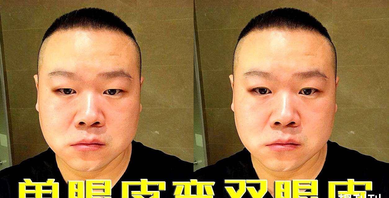 单眼皮内娱最假双眼皮PK，就差割到脑门了，生怕别人看不出是割的？