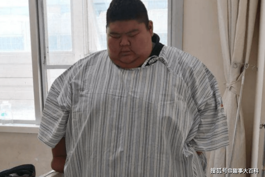 山东第一胖重668斤为爱一年减重400斤如今爱情事业双丰收