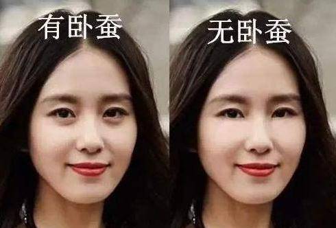 眼睛如果没了卧蚕眼，娱乐圈就没了美女？赵丽颖、杨幂就像老了10多岁