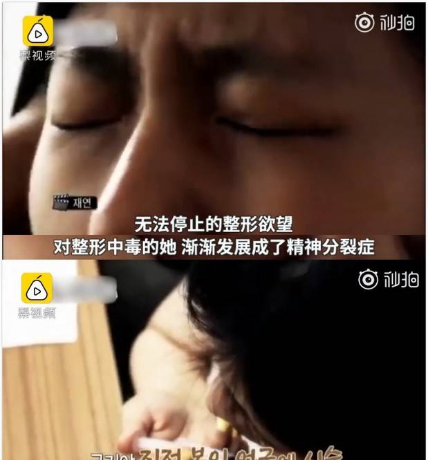 因为女星韩慧景：为了更漂亮，给脸注射食用油，把脸整成“猪头”