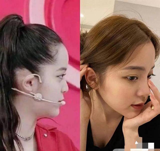 因为张柏芝水滴鼻输给了她，什么样的鼻子小成就美女完美的侧颜？
