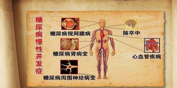 症状|血糖高了对人体有什么影响？若出现5个症状，小心糖尿病找上门