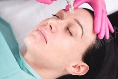 治疗欧洲之星做完多久有效果,隔壁阿姨一把年纪还那么爱美