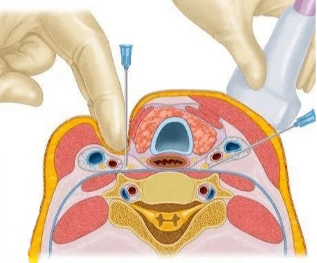 世界睡眠日行动起来消除顽固性失眠