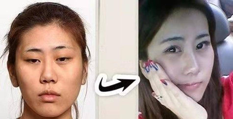 胸部16岁开始整容，花400多万整容200余次的“红粉宝宝”，如今怎样？