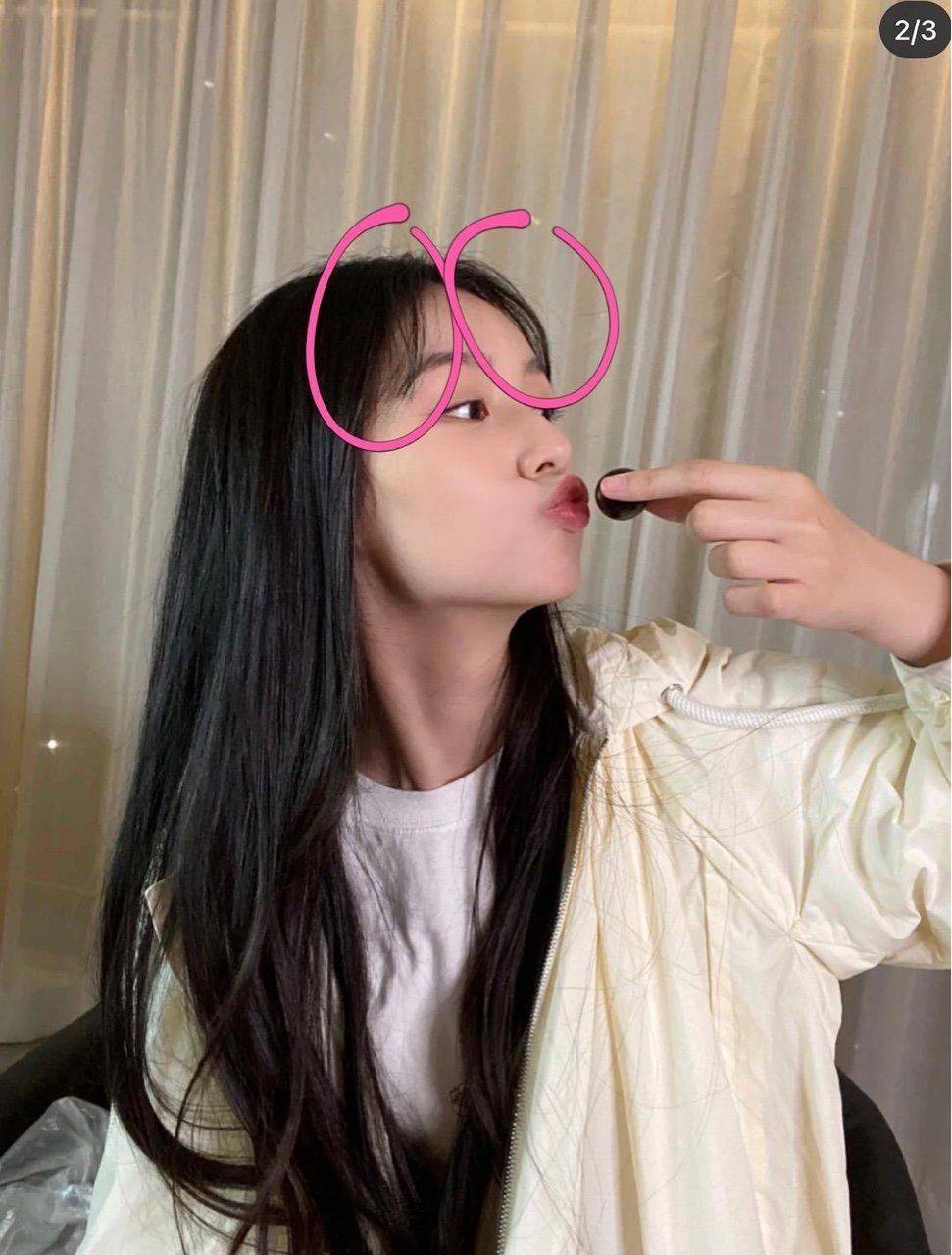 王者女明星头发也作假？原来看起来发量浓密的周也曾经也是秃头星人？
