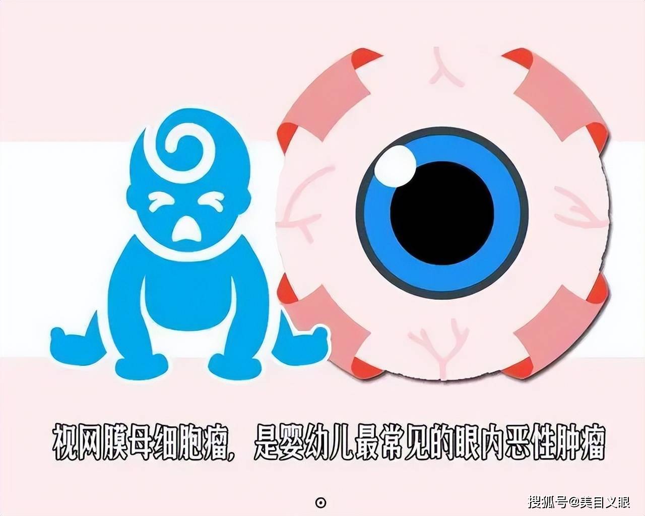 原创武汉美目义眼什么是rb儿童