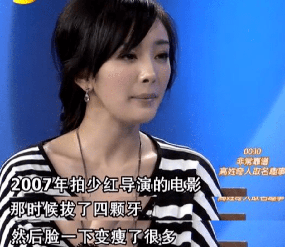 脸部明星整牙后遗症：杨幂脸部松弛，王嘉尔颧骨外扩，宋祖儿法令纹深！！