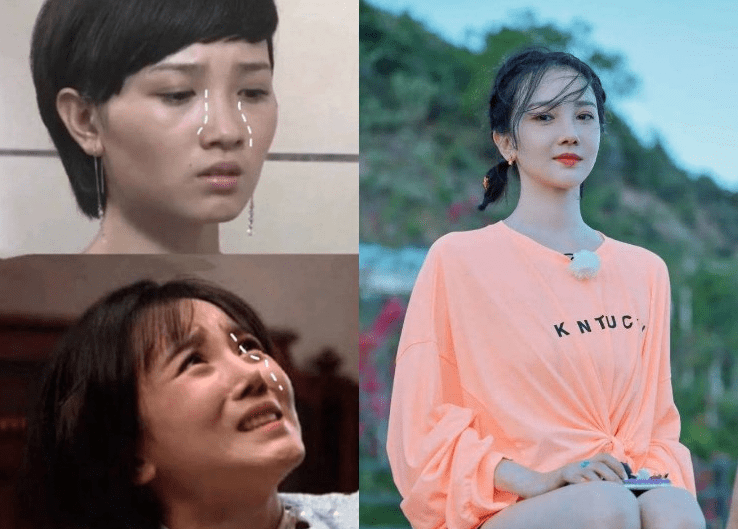 下巴整前似大妈、整完变少女？这些“回炉重造”的女明星，太成功了！