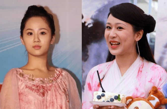 下巴整前似大妈、整完变少女？这些“回炉重造”的女明星，太成功了！