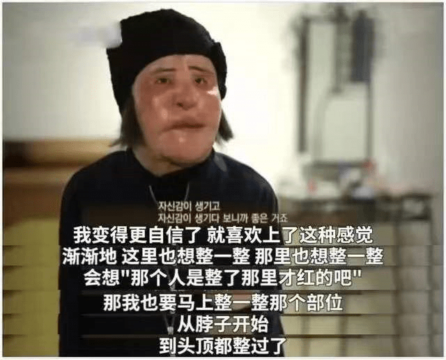 漂亮整容狂人韩慧景：昔日美貌如花，整容后事业全毁，57岁遗憾离世