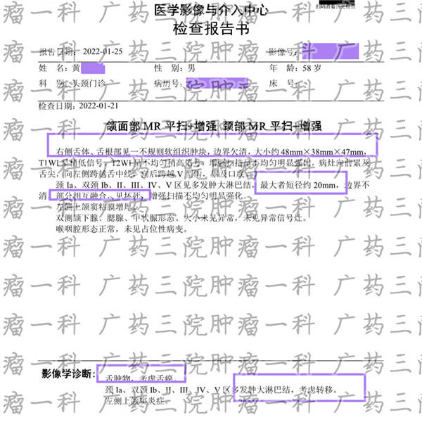 舌癌的治愈率是多少 患者 治疗 彭齐荣