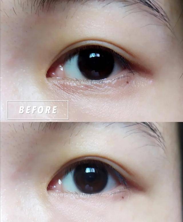 因为屈臣氏“被冷落”的眼霜,因价低备受“争议”,员工们却偷偷使用