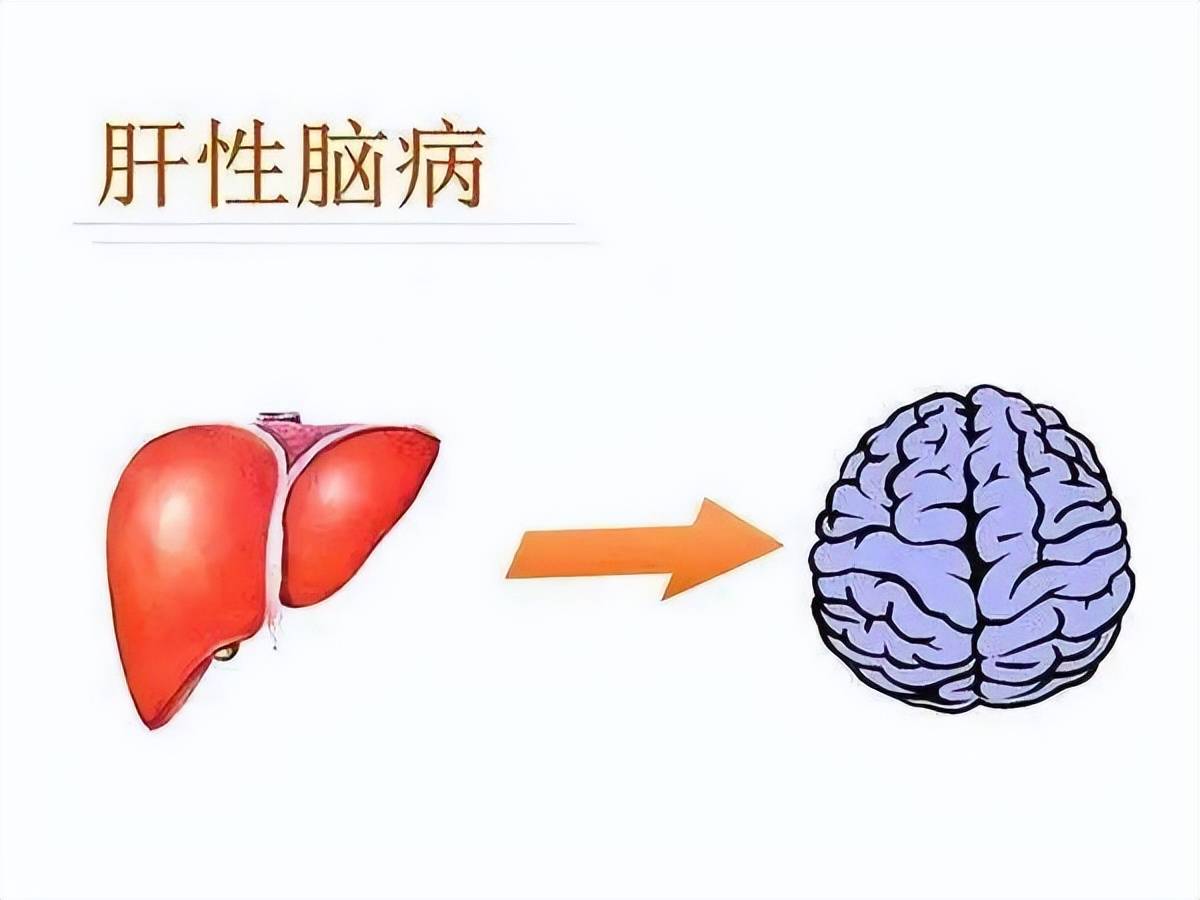 林先生|不把乙肝当回事？小心它来找你的事儿