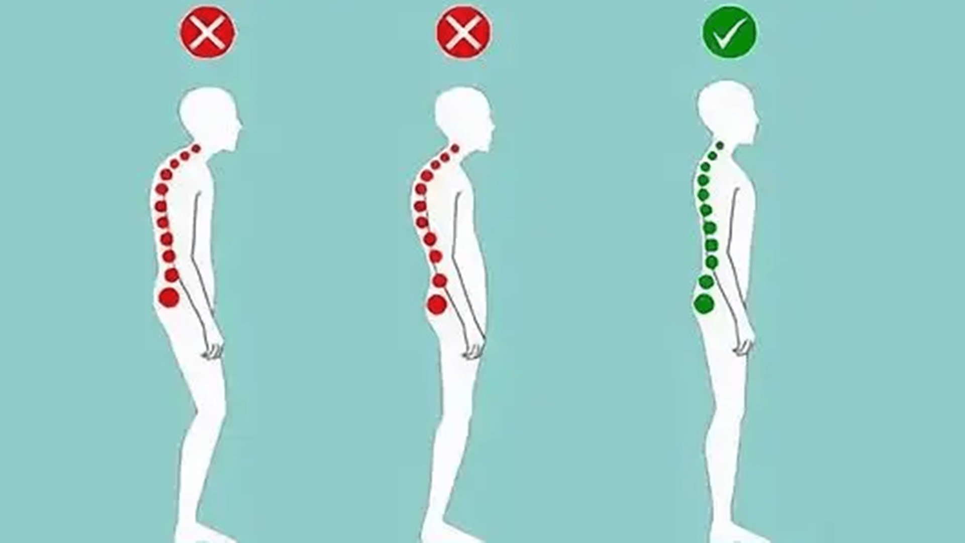 支具|脊柱不直怎么回事？脊柱歪了，是什么原因造成？