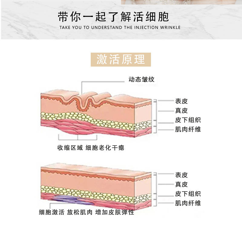 表皮层阿尔玛LVALMA微整轻医美到底可不可靠？