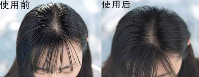 因为建议女生：头发扁塌出油快，外出前加上这一步头发清爽蓬松显气质
