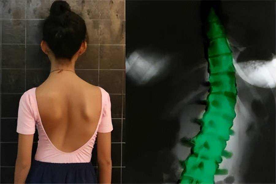 【育陶荟】健康的导向,是孩子一生的事业_体态_青少年_生活