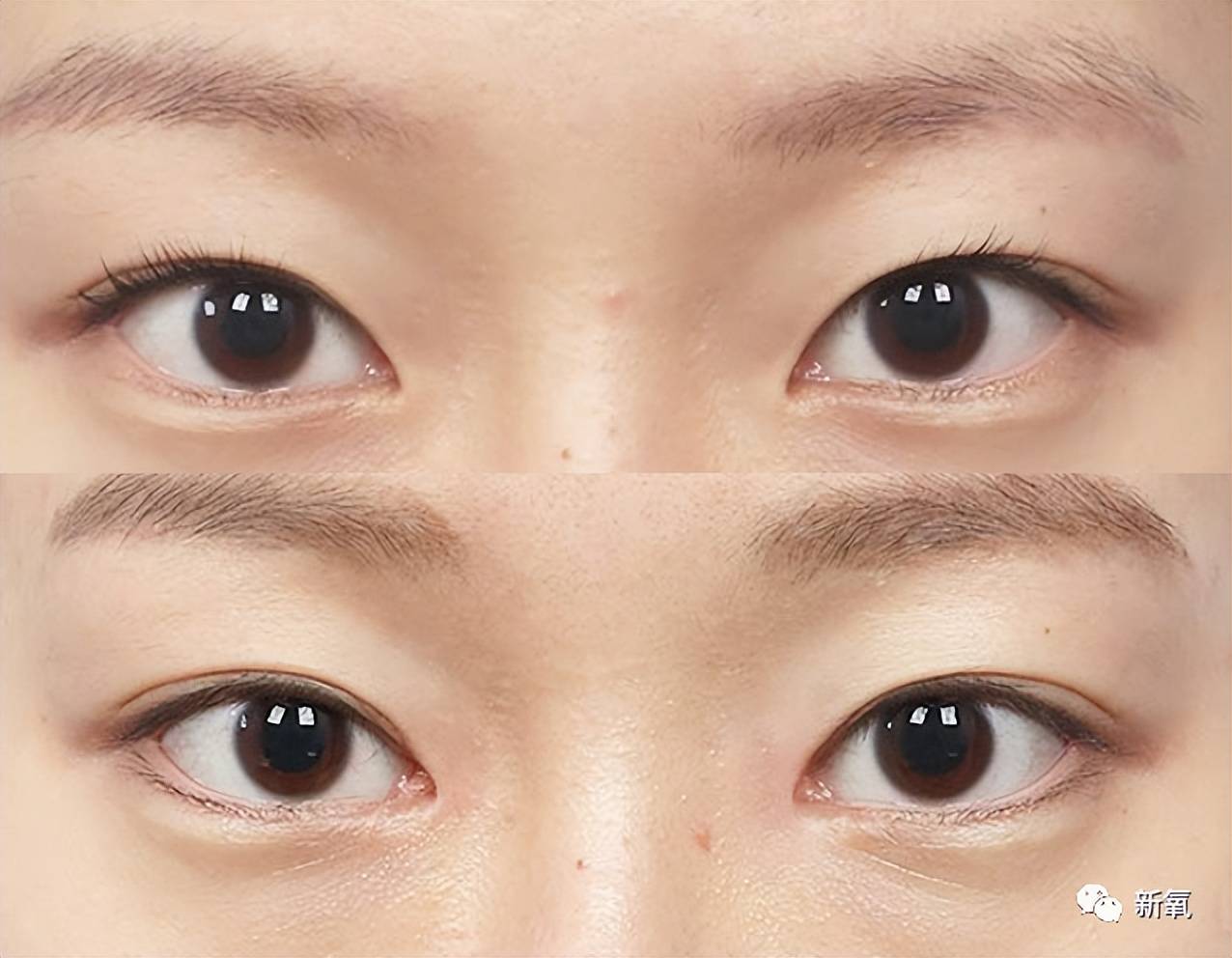 看起来很没精神的;3,双眼皮很短,前半部分被蒙古褶挡住看起来很不清晰