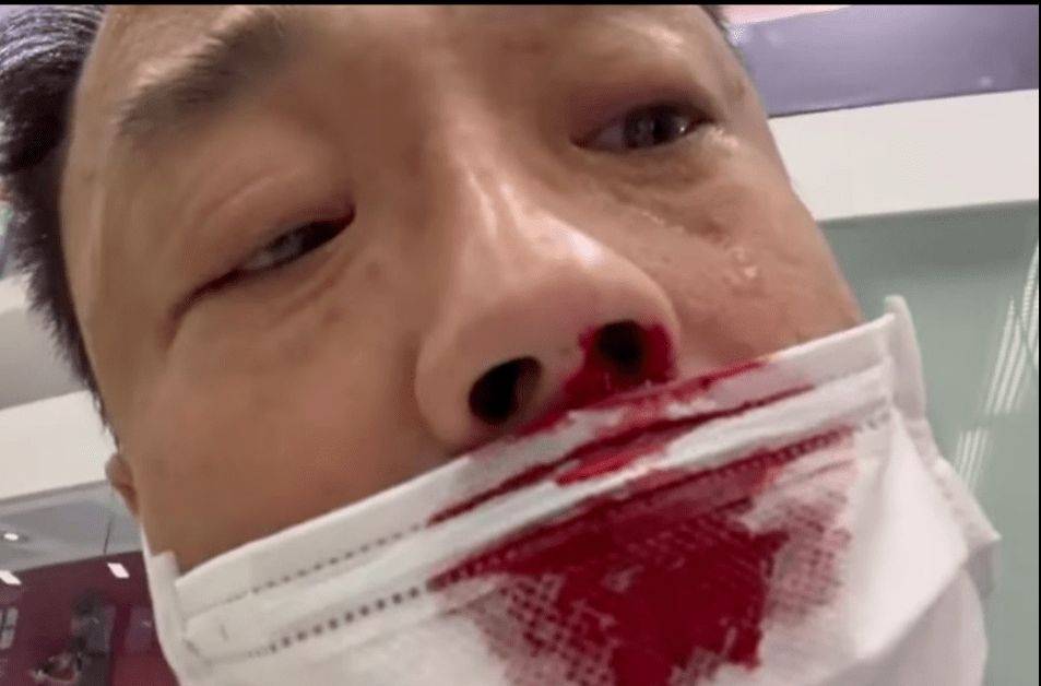 台湾省发现xe变种男演员入台核酸检测被捅一脸血被骂活该