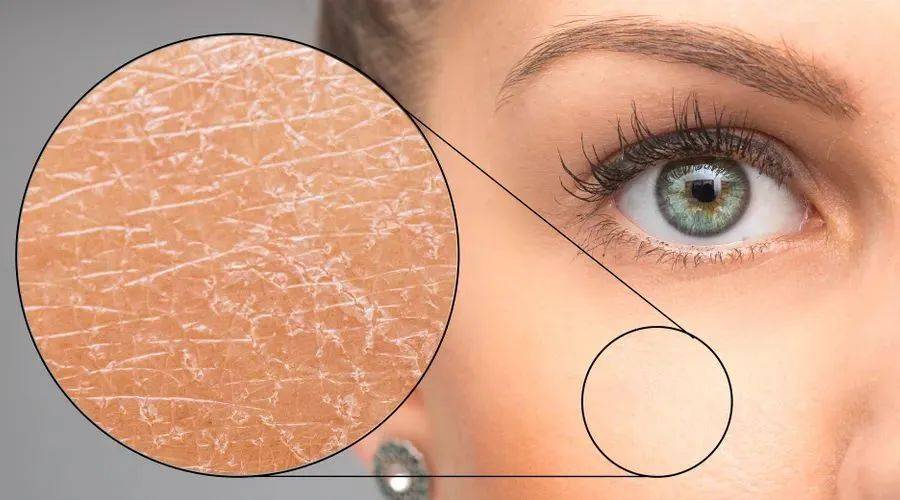 干敏皮春季自救指南_皮肤_修护_屏障