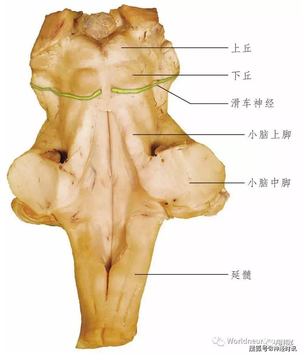 圖10.7 中腦水平切面(經下丘).