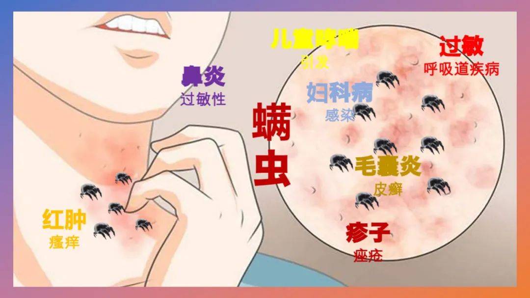 9 大避坑指南 # 3 - 11 螨虫(尘螨)的由来与危害_海恩斯坦_过敏原