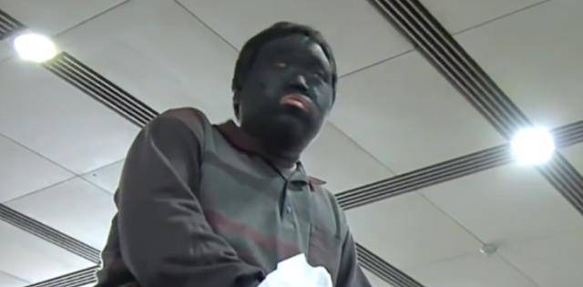 带着妹妹流浪10年,每天坚持用鞋油抹脸,只为保护妹妹_许勇_黑脸_皮肤