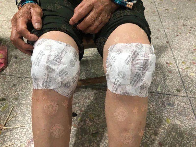 膝关节疼痛不用愁中科盛元中医敷疗为您解忧