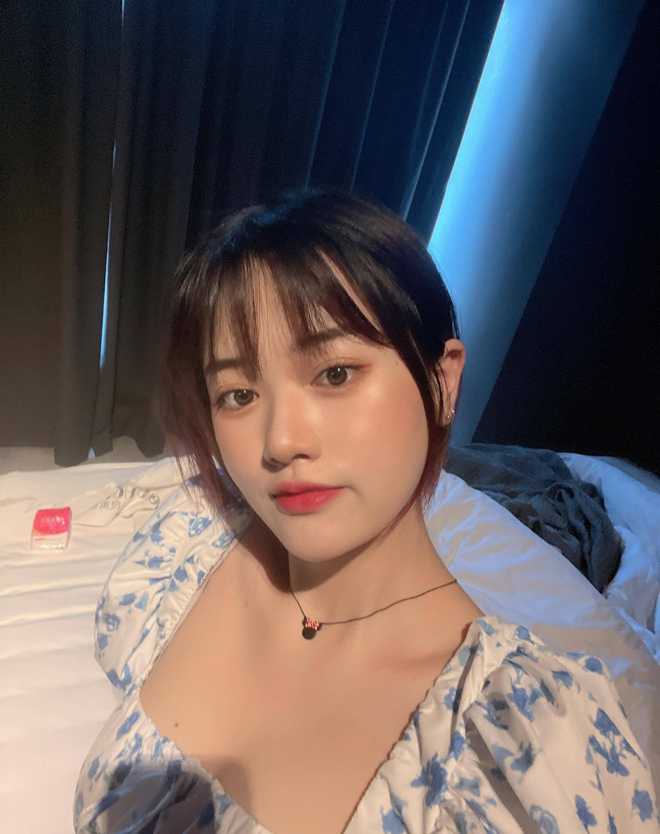 原创25岁小姐姐做完面部吸脂60天父母以为我悄悄换了一张脸