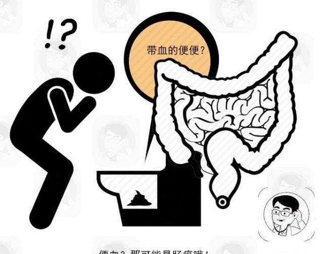 原創腸癌發病年輕化醫生告誡4個信號莫大意早發現早治療