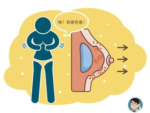 女性需警惕"不死的癌症",四种方法可诊断_肿块_乳房_检查
