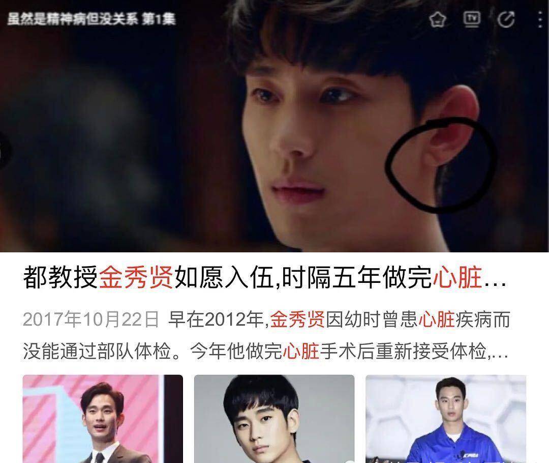 发现早有先兆,而王俊凯也出现该状况,这下粉丝懵了_身体_耳朵_情况