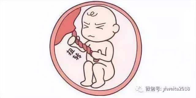 引起胎盘和脐带血流不足的因素有很多,比如胎盘功能减退,脐带扭转等.