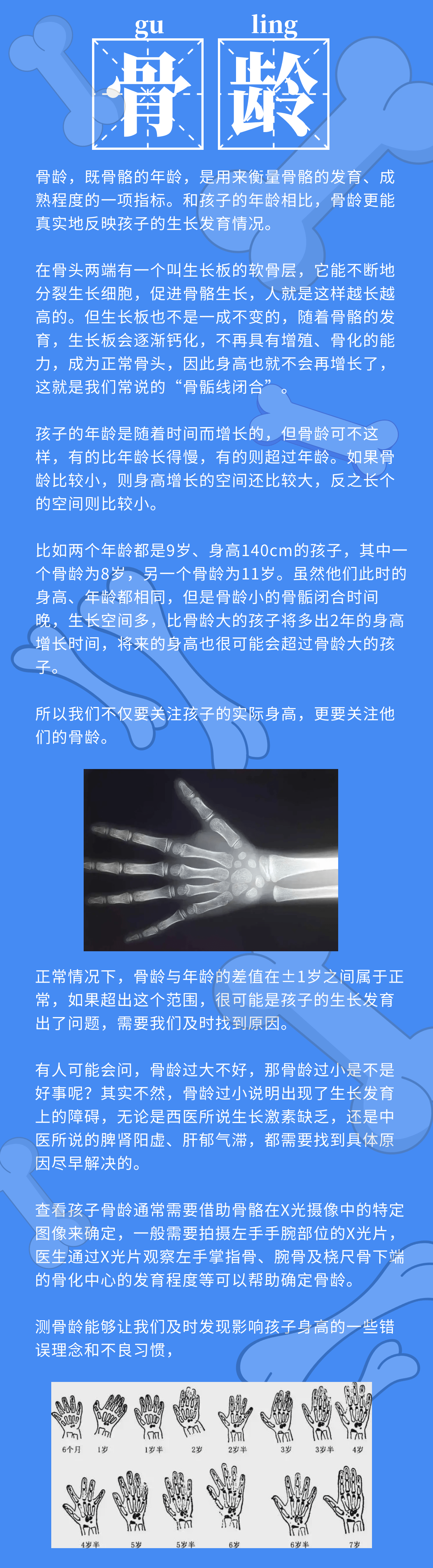 成都華西生長發育研究院骨齡正確瞭解骨齡科學對待孩子身高發育問題