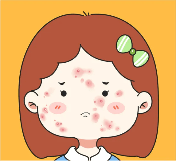 脸上长了痘印痘坑怎么办