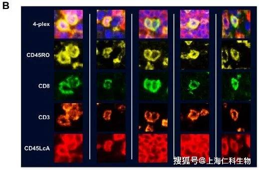 靶標分子檢測多重免疫熒光染色檢測分析方案