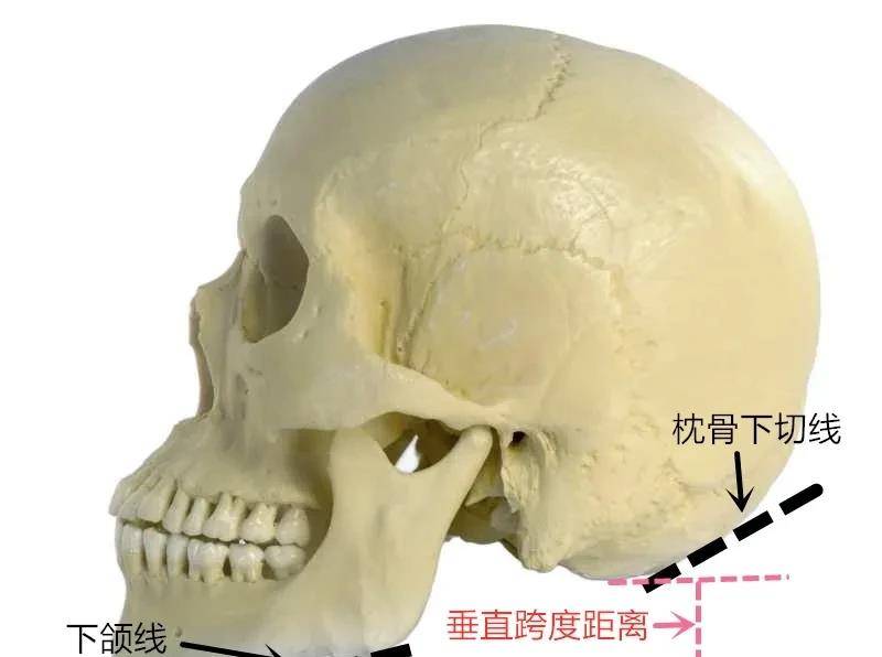 枕骨下緣和下頜線在豎直維度上跨度太大,也會造成後腦和下巴脫離的