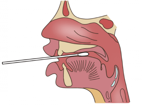 咽拭子卡通图片