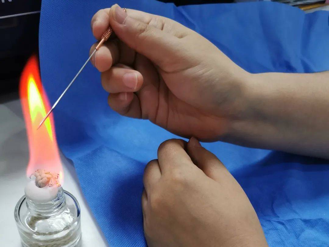 医院针灸推拿康复科中医特色疗法方氏头针我们还有——除了毫针适用