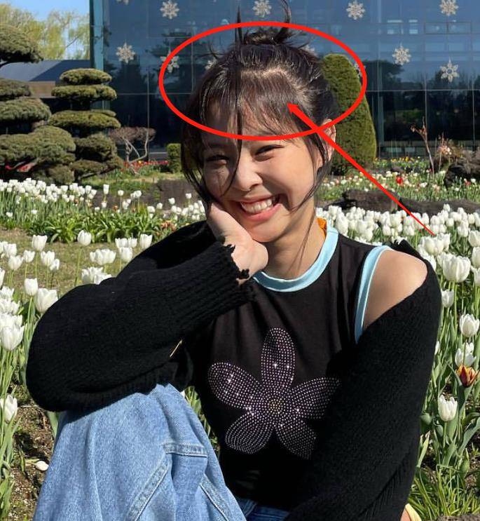 jennie晒春游照,素颜出镜露又纯又辣,她的发际线却令人堪忧