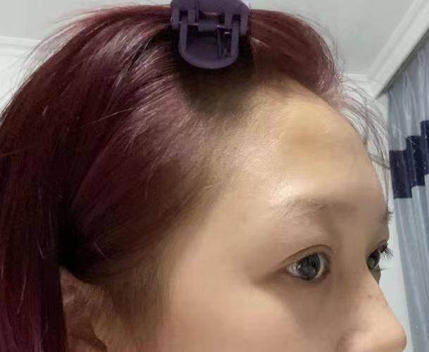 额头有个凹陷代表什么