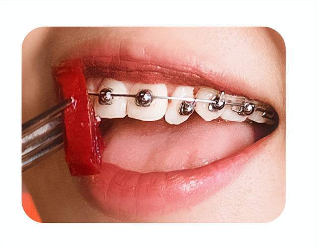 自制冰墩墩野生球托二次创作需注意专利保护